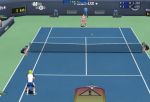  #4 - Tennis Elbow